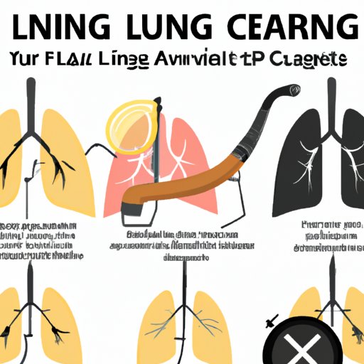 Living with Lung Cancer Without Treatment: What to Expect