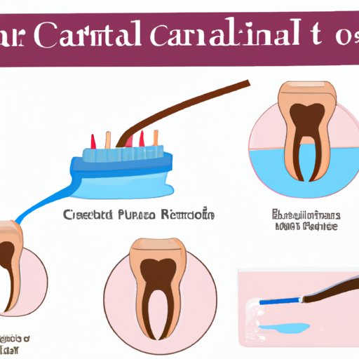 VII. Alternatives to Root Canal Treatment
