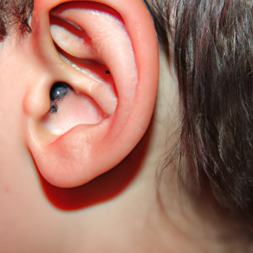 How To Treat Infected Ear Piercing Tips And Home Remedies The Cognition Sentinel 